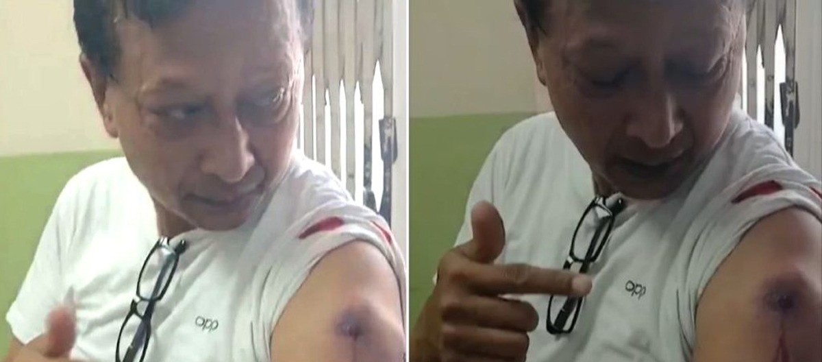 shyam-shrestha-injured.jpg